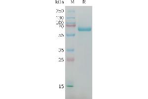 Mouse AFP Protein, His Tag on SDS-PAGE under reducing condition. (alpha Fetoprotein Protein (AA 21-605) (His tag))