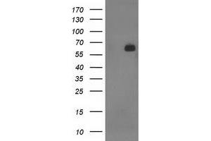 HEK293T cells were transfected with the pCMV6-ENTRY control (Left lane) or pCMV6-ENTRY SH2B3 (Right lane) cDNA for 48 hrs and lysed. (SH2B3 anticorps)