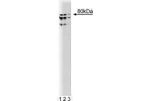 Western Blotting (WB) image for anti-Coilin (COIL) (AA 226-332) antibody (ABIN968730) (Coilin anticorps  (AA 226-332))