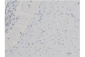 ABIN6267390 at 1/200 staining Human esophagus tissue sections by IHC-P. (ATF2 anticorps  (pThr53, pThr71))