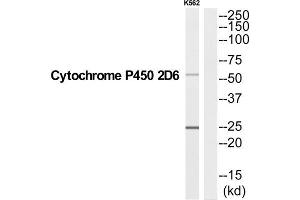 Western Blotting (WB) image for anti-Cytochrome P450, Family 2, Subfamily D, Polypeptide 6 (CYP2D6) (C-Term) antibody (ABIN1852641) (CYP2D6 anticorps  (C-Term))
