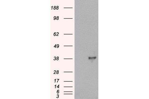 DOK5 anticorps  (C-Term)
