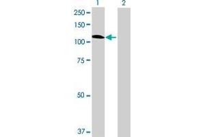 Lane 1: GBA2 transfected lysate ( 102. (GBA2 293T Cell Transient Overexpression Lysate(Denatured))