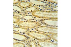 Immunohistochemistry analysis in formalin fixed and paraffin embedded lung tissue reacted with 17-beta-HSD11 / HSD17B11 Antibody (N-term) followed which was peroxidase conjugated to the secondary antibody and followed by DAB staining. (HSD17B11 anticorps  (N-Term))