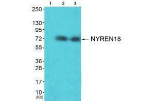 Western blot analysis of extracts from HuvEc cells (Lane 2) and JK cells (Lane 3), using NYREN18 antiobdy. (NUB1 anticorps  (C-Term))