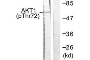 Western blot analysis of extracts from NIH-3T3 cells treated with TNF-a 20ng/ml 30', using Akt (Phospho-Thr72) Antibody. (AKT1 anticorps  (pThr72))