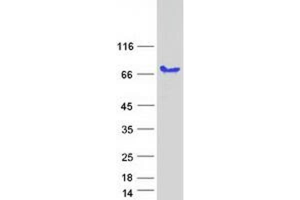 Paralemmin 2 Protein (PALM2) (Transcript Variant 2) (Myc-DYKDDDDK Tag)