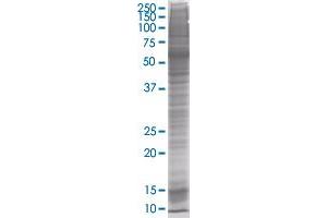 CSTB transfected lysate (CSTB 293T Cell Transient Overexpression Lysate(Denatured))