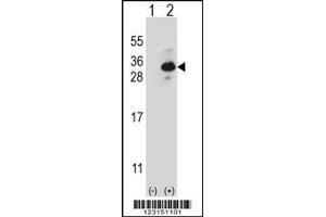 Western blot analysis of CLTB using rabbit polyclonal CLTB Antibody using 293 cell lysates (2 ug/lane) either nontransfected (Lane 1) or transiently transfected (Lane 2) with the CLTB gene. (CLTB anticorps)