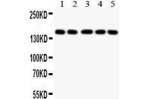 Anti- COL2A1 antibody, Western blotting All lanes: Anti COL2A1  at 0. (COL2A1 anticorps  (C-Term))