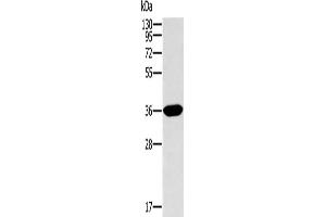 Gel: 10 % SDS-PAGE, Lysate: 40 μg, Lane: Human fetal intestine tissue, Primary antibody: ABIN7129939(ITLN1 Antibody) at dilution 1/400, Secondary antibody: Goat anti rabbit IgG at 1/8000 dilution, Exposure time: 2 minutes (ITLN1/Omentin anticorps)