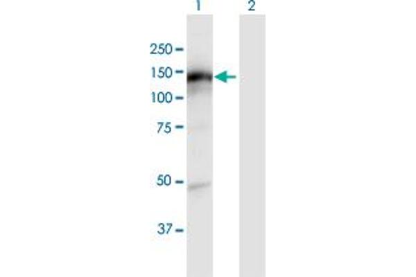 CEMIP anticorps  (AA 1-992)