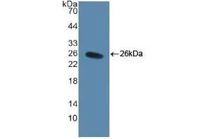 Detection of Recombinant CD40L, Human using Polyclonal Antibody to Cluster Of Differentiation 40 Ligand (CD40L) (CD40 Ligand anticorps  (AA 48-244))