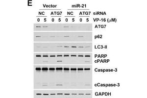 Western Blotting (WB) image for anti-Sequestosome 1 (SQSTM1) antibody (ABIN2854836)