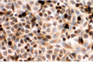 Anti-Cytochrome P450 Reductase antibody, ICC ICC: HELA Cell (POR anticorps  (C-Term))