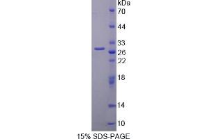 Image no. 1 for phosphoprotein Associated with Glycosphingolipid Microdomains 1 (PAG1) (AA 138-357) protein (His tag) (ABIN6238131) (PAG1 Protein (AA 138-357) (His tag))