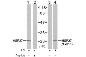 Image no. 2 for anti-Heat Shock 27kDa Protein 1 (HSPB1) (pSer15) antibody (ABIN196895) (HSP27 anticorps  (pSer15))