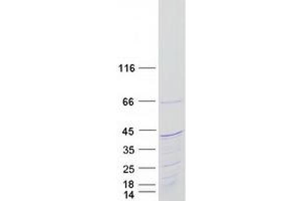 KIAA1191 Protein (KIAA1191) (Transcript Variant 1) (Myc-DYKDDDDK Tag)