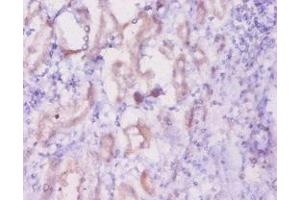 Immunohistochemistry of paraffin-embedded human kidney tissue using  at dilution of 1:20 (Inhibin alpha anticorps  (AA 233-366))