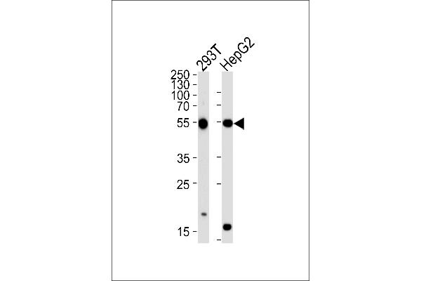 PHKG1 anticorps