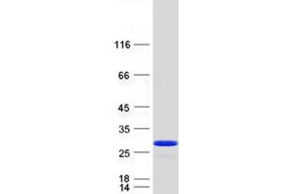 LOH12CR1 Protein (Myc-DYKDDDDK Tag)