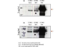 Western Blot Analysis of anti-human CCM-2. (CCM2 anticorps  (N-Term))