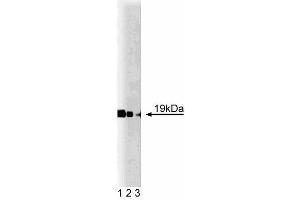 Western blot analysis of Cofilin on mouse cerebrum lysate. (Cofilin anticorps  (AA 3-98))