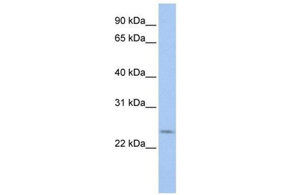 PRELID2 anticorps  (C-Term)