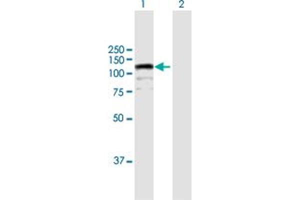 CIZ1 anticorps  (AA 1-818)