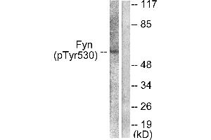 Western blot analysis of extracts from 293 cells, treated with H2O2 (100uM, 15mins), using Fyn (Phospho-Tyr530) antibody (#A0430). (FYN anticorps  (pTyr530))