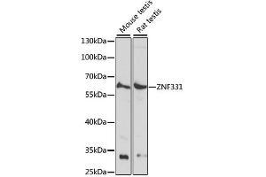 Western blot analysis of extracts of various cell lines, using ZNF331 antibody (ABIN6291097) at 1:1000 dilution. (ZNF331 anticorps)