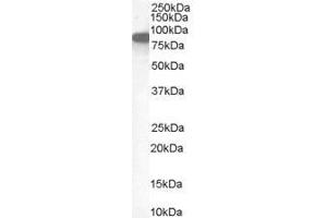 Western Blotting (WB) image for anti-Ezrin (EZR) antibody (ABIN5886568) (Ezrin anticorps)