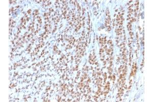 Formalin-fixed, paraffin-embedded human Colon stained with Retinoblastoma (Rb1) Monoclonal Antibody (1F8). (Retinoblastoma 1 anticorps)