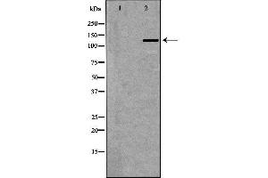 Western blot analysis of extracts of placenta, using NOS3 antibody. (ENOS anticorps  (Internal Region))