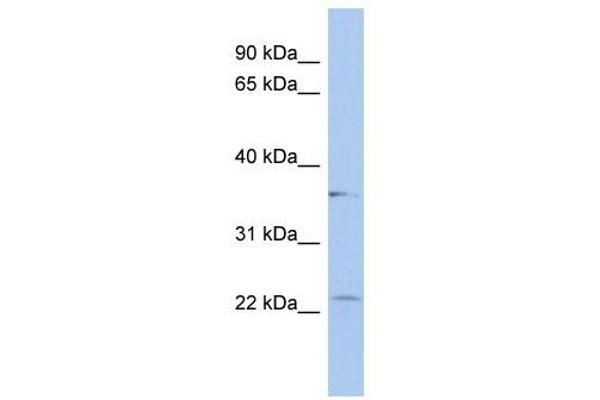 LYSMD2 anticorps  (Middle Region)