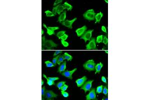 Immunofluorescence analysis of  cells using HSP27/HSP27/HSPB1 antibody (ABIN6128036, ABIN6142051, ABIN6142053 and ABIN6217766). (HSP27 anticorps  (AA 1-100))