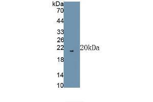 Detection of Recombinant FGF2, Rat using Polyclonal Antibody to Fibroblast Growth Factor 2, Basic (FGF2) (FGF2 anticorps)