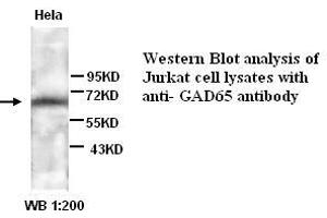 Image no. 1 for anti-Glutamate Decarboxylase 2 (Pancreatic Islets and Brain, 65kDa) (GAD2) antibody (ABIN790972) (GAD65 anticorps)