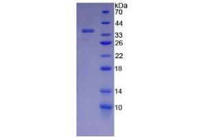 SDS-PAGE (SDS) image for Endoplasmic Reticulum To Nucleus Signaling 1 (ERN1) (AA 571-832) protein (His tag) (ABIN6240002) (ERN1 Protein (AA 571-832) (His tag))