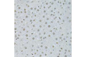 Immunohistochemistry of paraffin-embedded rat liver using HNRNPK Antibody. (HNRNPK anticorps)