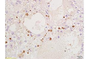 Immunohistochemistry (Paraffin-embedded Sections) (IHC (p)) image for anti-Cyclin-Dependent Kinase Inhibitor 1B (p27, Kip1) (CDKN1B) (AA 150-198) antibody (ABIN672621)