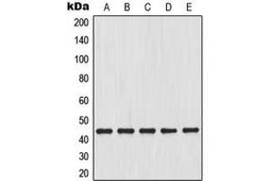 Western blot analysis of MKK4 expression in HeLa (A), HepG2 (B), K562 (C), A431 (D), L929 (E) whole cell lysates. (MAP2K4 anticorps  (Center))