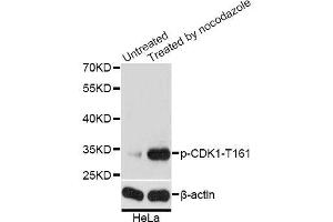 Western blot analysis of extracts of HeLa cells, using Phospho-CDK1-T161 antibody (ABIN5969957) at 1/2000 dilution. (CDK1 anticorps  (pThr161))