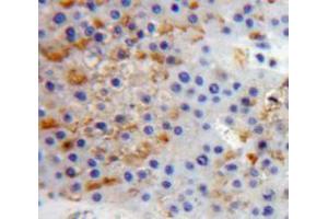 Used in DAB staining on fromalin fixed paraffin-embedded Liver tissue (PTPRS anticorps  (AA 77-361))