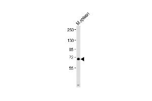 Anti-L Antibody (C-Term) at 1:2000 dilution + Mouse spleen lysate Lysates/proteins at 20 μg per lane. (MPL anticorps  (AA 514-546))