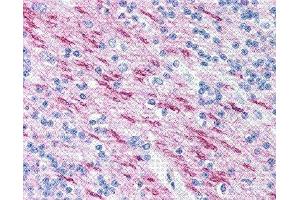 Immunohistochemistry (IHC) image for anti-Myelin Basic Protein (MBP) (AA 84-89) antibody (ABIN2475508) (MBP anticorps  (AA 84-89))