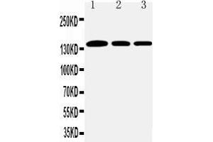 Western Blotting (WB) image for anti-Collagen, Type I, alpha 1 (COL1A1) (AA 1192-1207), (C-Term) antibody (ABIN5518708)