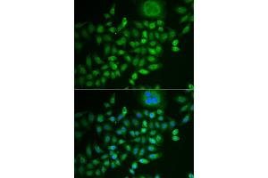 Immunofluorescence analysis of MCF-7 cells using SCG2 antibody. (SCG2 anticorps)