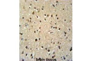 Immunohistochemistry (IHC) image for anti-threonine Synthase-Like 2 (THNSL2) antibody (ABIN3002296) (THNSL2 anticorps)