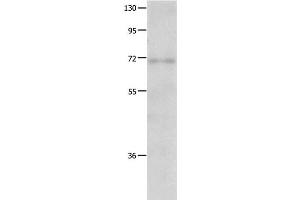 Western Blot analysis of Human fetal lung tissue using IGF2BP1 Polyclonal Antibody at dilution of 1:500 (IGF2BP1 anticorps)